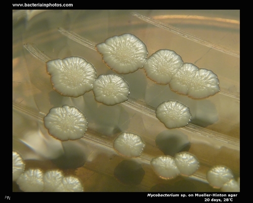 mycobacterium colonies on mueller hinton agar